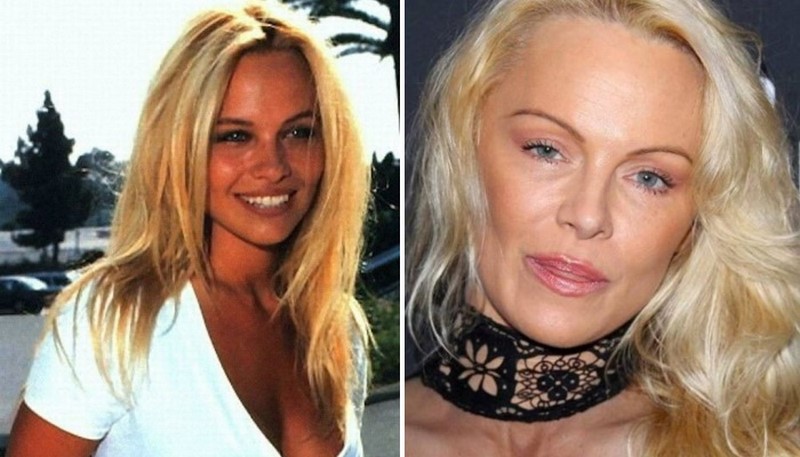 4) Pamela Anderson