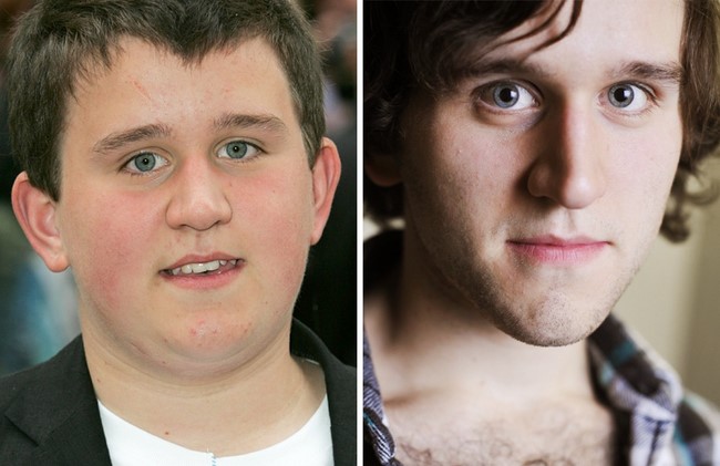 Harry Melling