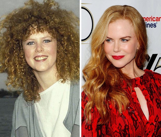 Nicole Kidman 1983