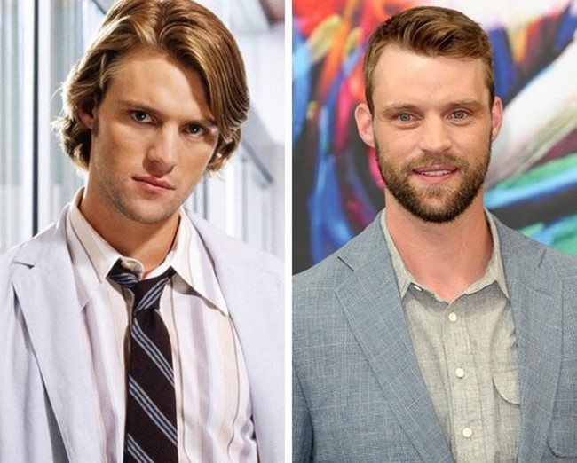 Dr. Robert Chase, 2004 / Jesse Spencer, 2016 