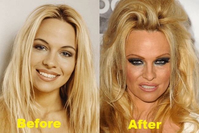 2. Pamela Anderson