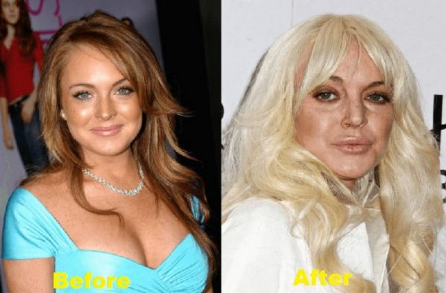 3. Lindsay Lohan