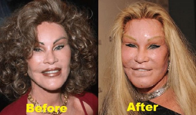 6. Jocelyn Wildenstein