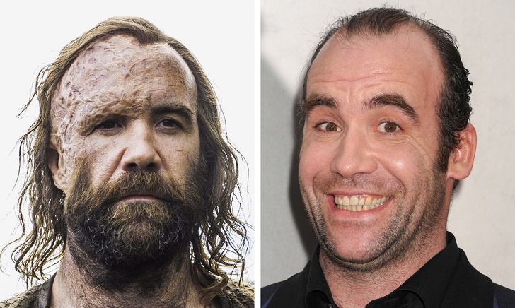 7) Sandor ’The Hound’ Clegane — Rory McCann