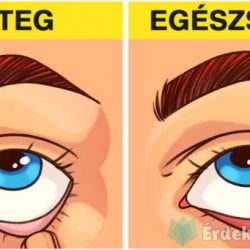 8 egészségügyi vizsgálat, amit akár mi is elvégezhetünk magunkon