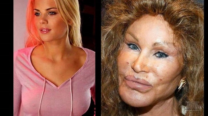 Jocelyn Wildenstein