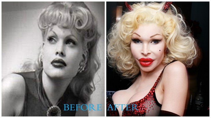 Amanda Lepore