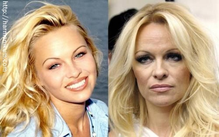 11. Pamela Anderson